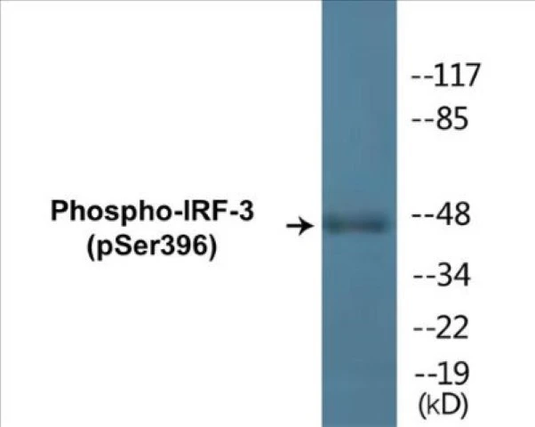 IRF-3 (phospho Ser396) Cell Based ELISA Kit (A102123-296)