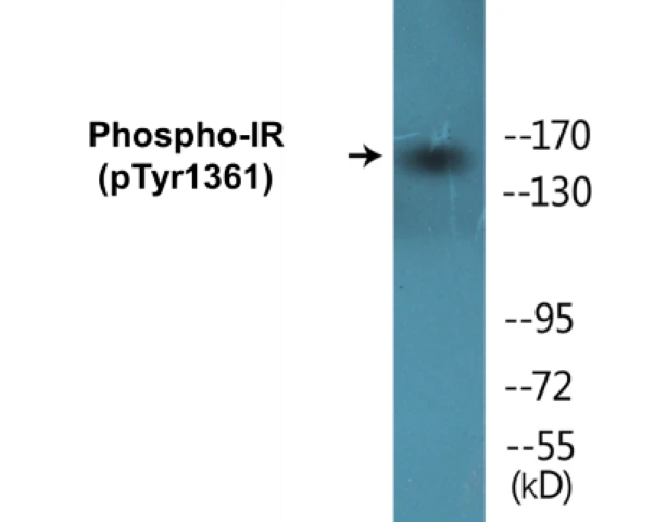 IR (phospho Tyr1361) Cell Based ELISA Kit (A102420-296)