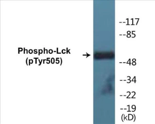 Lck (phospho Tyr505) Cell Based ELISA Kit (A102399-296)