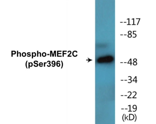 MEF2C (phospho Ser396) Cell Based ELISA Kit (A102633-296)