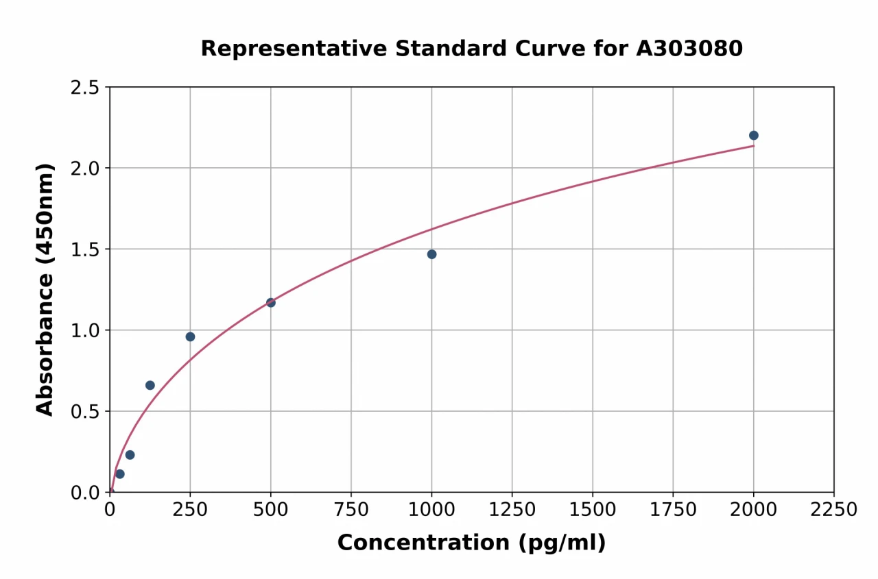 Human DYRK1A ELISA Kit (A303080-96)