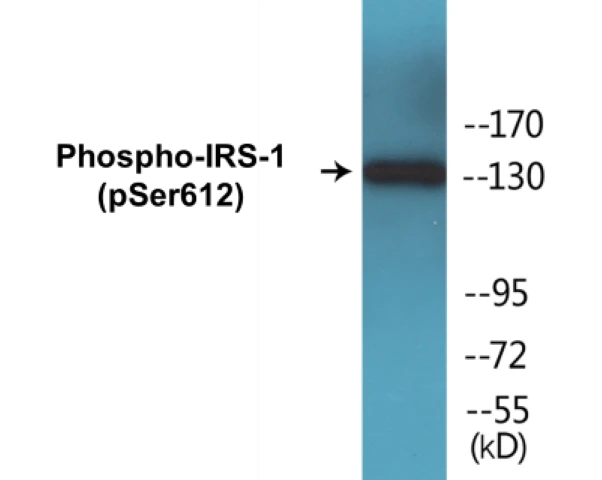 IRS-1 (phospho Ser612) Cell Based ELISA Kit (A102151-296)