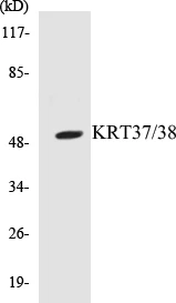 KRT37 + 38 Cell Based ELISA Kit (A103628-96)