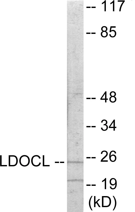 LDOC1L Cell Based ELISA Kit (A103419-96)