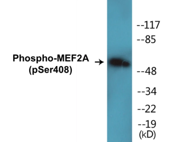 MEF2A (phospho Ser408) Cell Based ELISA Kit (A102165-296)