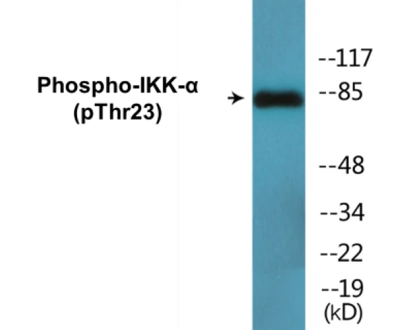 IKK alpha (phospho Thr23) Cell Based ELISA Kit (A102584-296)