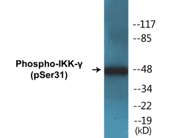 IKK gamma (phospho Ser31) Cell Based ELISA Kit (A102784-296)