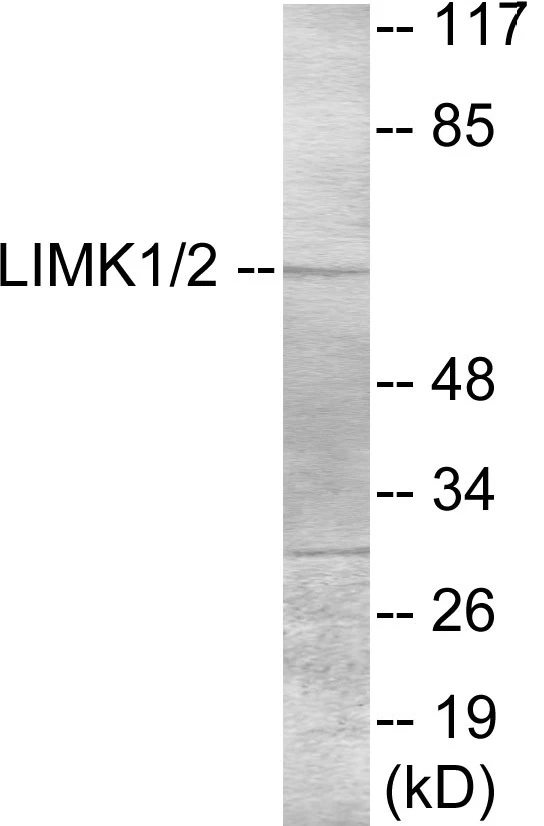 LIMK1 Cell Based ELISA Kit (A103076-96)