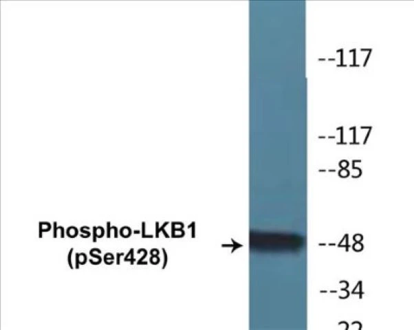 LKB1 (phospho Ser428) Cell Based ELISA Kit (A102636-296)