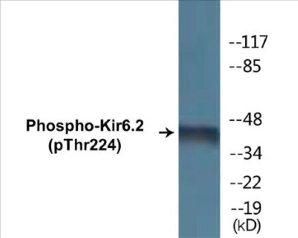 Kir6.2 (phospho Thr224) Cell Based ELISA Kit (A102601-296)