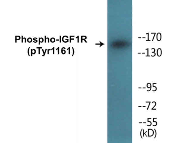 IGF1R (phospho Tyr1161) Cell Based ELISA Kit (A102076-296)