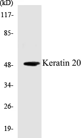 Keratin 20 Cell Based ELISA Kit (A102895-96)