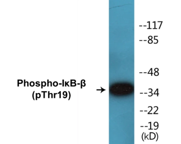 I&#0954;B beta (phospho Thr19) Cell Based ELISA Kit (A102706-296)