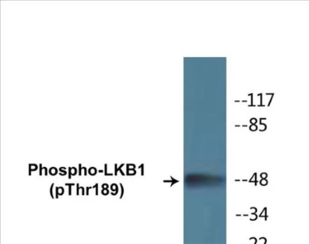 LKB1 (phospho Thr189) Cell Based ELISA Kit (A102648-296)