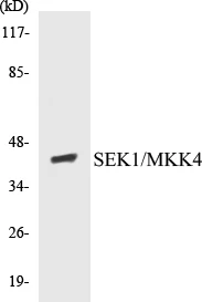 MKK4 Cell Based ELISA Kit (A103204-96)