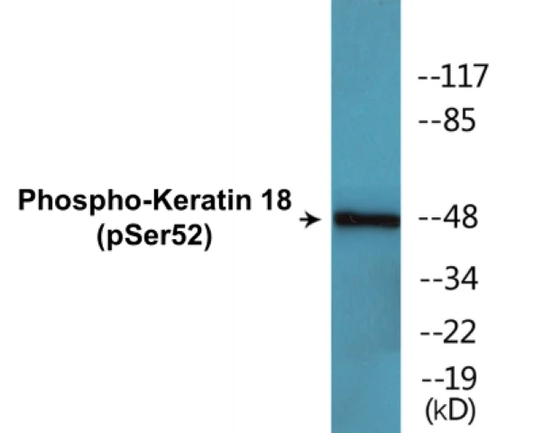 Keratin 18 (phospho Ser52) Cell Based ELISA Kit (A102777-296)