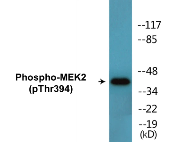 MEK2 (phospho Thr394) Cell Based ELISA Kit (A102339-296)