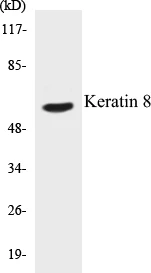 Keratin 8 Cell Based ELISA Kit (A103383-96)