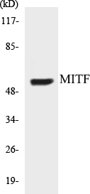 MITF Cell Based ELISA Kit (A103497-96)