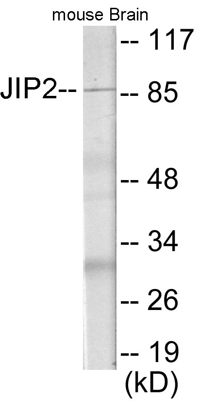 JIP2 Cell Based ELISA Kit (A103293-96)