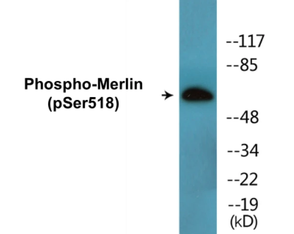 Merlin (phospho Ser518) Cell Based ELISA Kit (A102104-296)