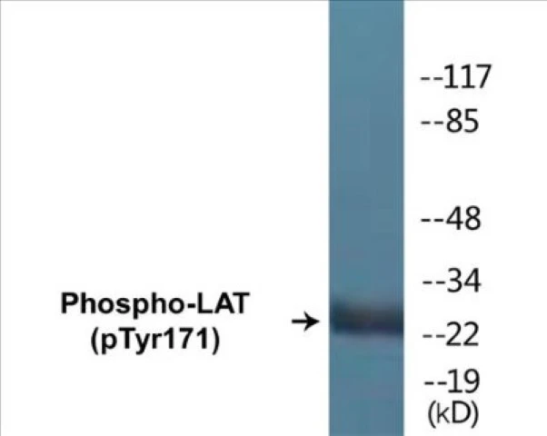 LAT (phospho Tyr171) Cell Based ELISA Kit (A102426-296)