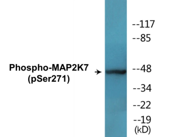 MAP2K7 (phospho Ser271) Cell Based ELISA Kit (A102109-296)