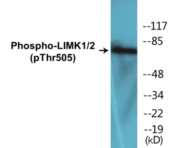 LIMK1 + 2 (phospho Thr505) Cell Based ELISA Kit (A102554-296)