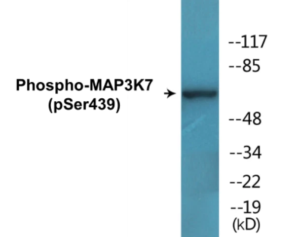 MAP3K7 (phospho Ser439) Cell Based ELISA Kit (A102108-296)