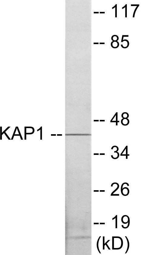 KAP1 Cell Based ELISA Kit (A103280-96)