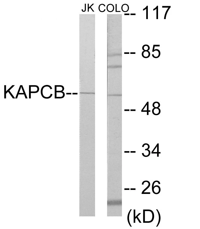 KAPCB Cell Based ELISA Kit (A103140-96)