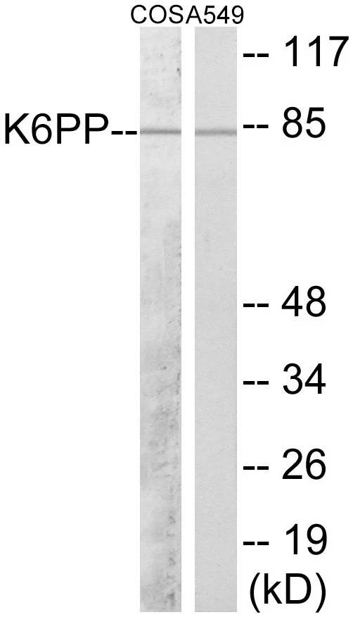 K6PP Cell Based ELISA Kit (A103288-96)