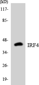 IRF4 Cell Based ELISA Kit (A103492-96)