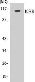 KSR Cell Based ELISA Kit (A103568-96)