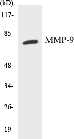 MMP-9 Cell Based ELISA Kit (A103672-96)