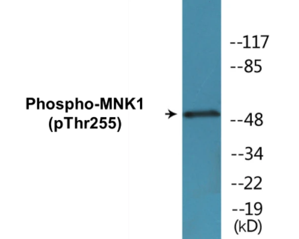 MNK1 (phospho Thr255) Cell Based ELISA Kit (A102350-296)