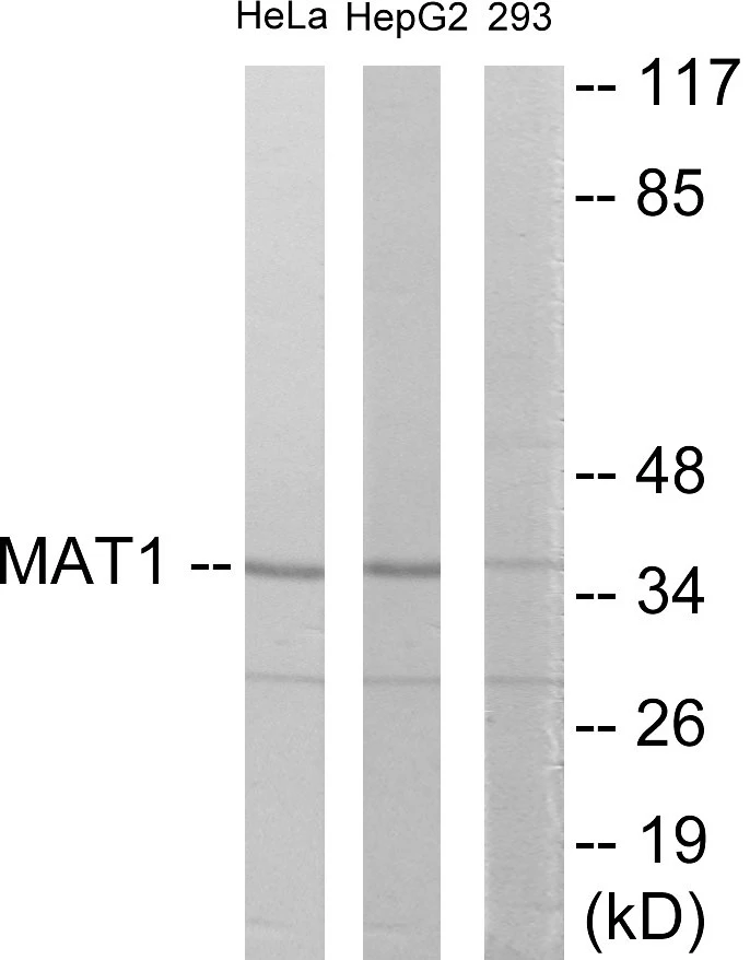 MAT1 Cell Based ELISA Kit (A103285-96)