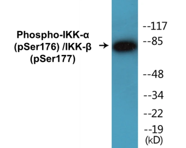 IKK alpha (phospho Ser176) + IKK beta (phospho Ser177) Cell Based ELISA Kit (A102036-296)