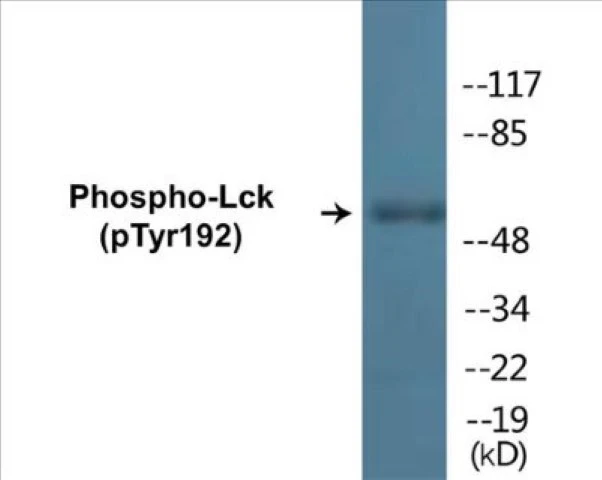 Lck (phospho Tyr192) Cell Based ELISA Kit (A102422-296)