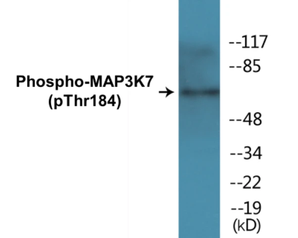 MAP3K7 (phospho Thr184) Cell Based ELISA Kit (A102102-296)