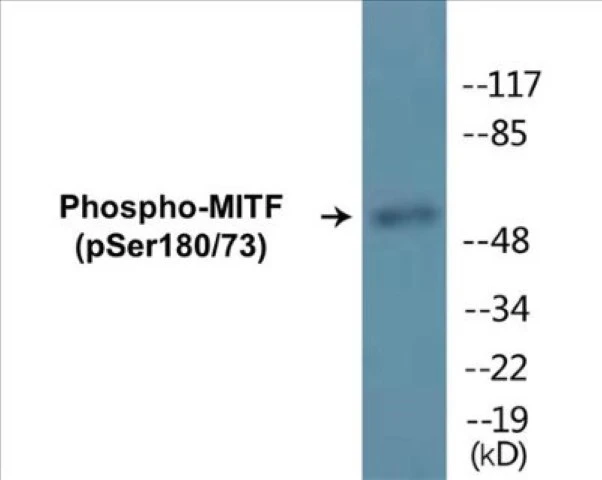 MITF (phospho Ser180 + Ser73) Cell Based ELISA Kit (A102681-296)