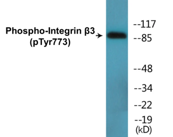 Integrin beta 3 (phospho Tyr773) Cell Based ELISA Kit (A102242-296)