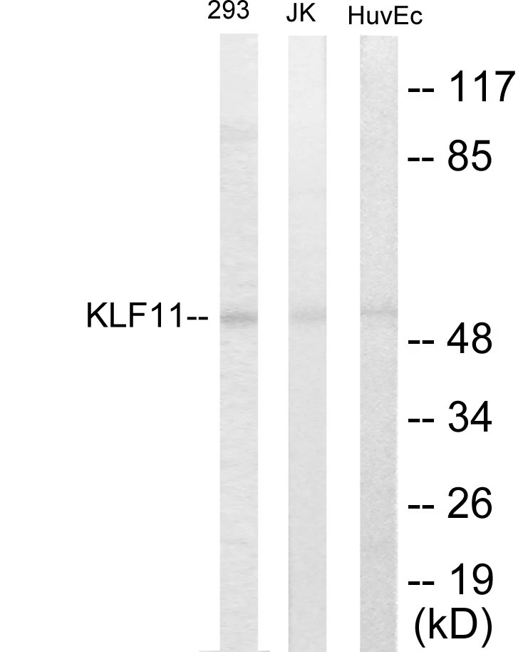 KLF11 Cell Based ELISA Kit (A103459-96)