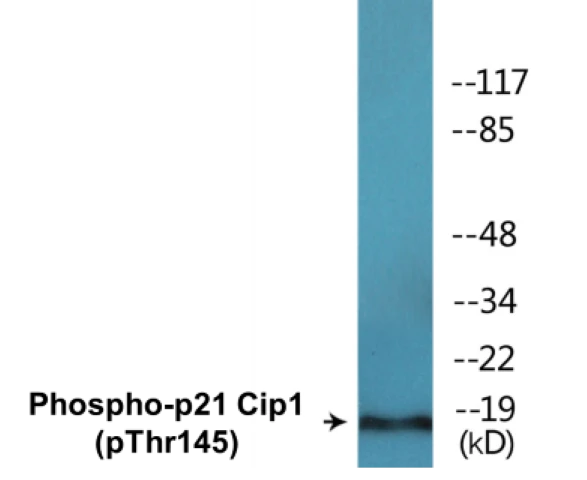 p21 Cip 1 (phospho Thr145) Cell Based ELISA Kit (A102559-296)