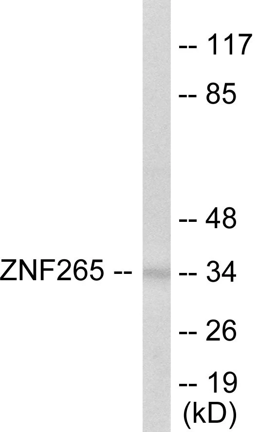 ZNF265 Cell Based ELISA Kit (A103020-96)