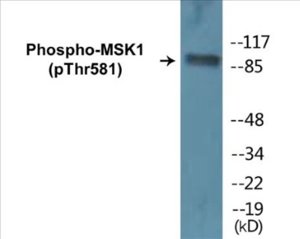 MSK1 (phospho Thr581) Cell Based ELISA Kit (A102649-296)