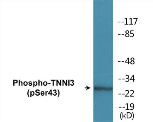 TNNI3 (phospho Ser43) Cell Based ELISA Kit (A102309-296)