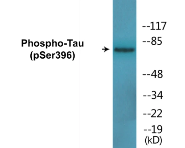 Tau (phospho Ser396) Cell Based ELISA Kit (A103838-296)