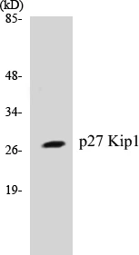 p27 Kip 1 Cell Based ELISA Kit (A103629-96)