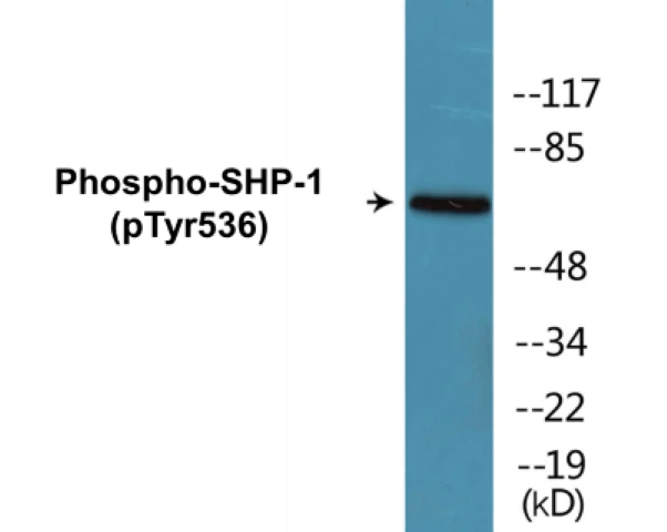 SHP-1 (phospho Tyr536) Cell Based ELISA Kit (A102130-296)